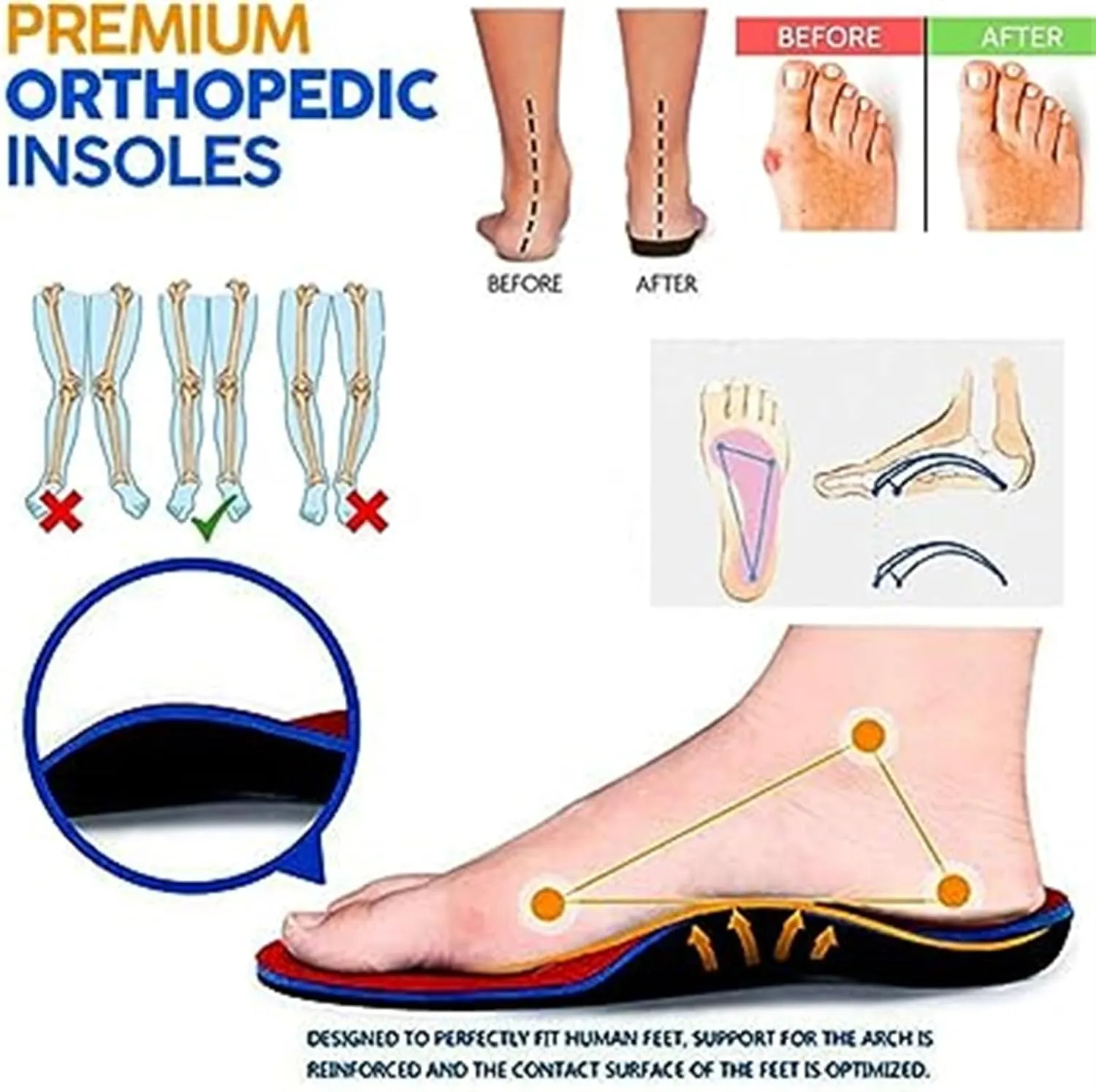 BBPM Sandals for Women Casual Summer Orthotic Flat Sandals Arch Support Plantar Fasciitis Sandals Open Toe Comfort Soft Sole Sandals Summer Casual Beach Slip on Shoes